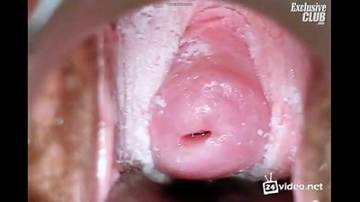 Binciken gynecological na kyakkyawar mace
